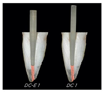 POSTES DE FIBRA DE VIDRIO CON DOBLE CONICIDAD PARA UNA MAYOR RESISTENCIA EN LA ZONA CORONAL Y MENOR DESGASTE APICAL