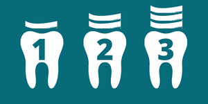 Blanqueamiento dental de clínica polivalente