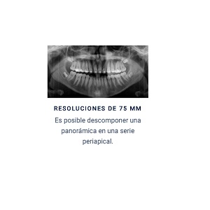 Óptima resolución, la mejor relación calida-resolución-precio