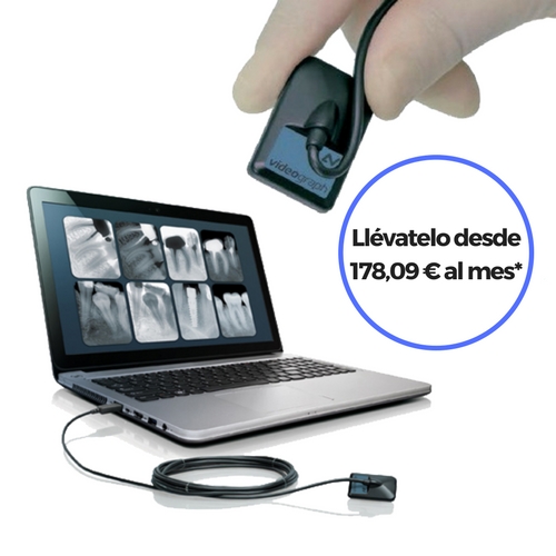 Captador Digital Radiovisiografía Videograph - Solución Diagnóstico Intraoral
