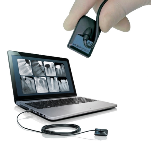 Captador Digital Radiovisiografía Videograph HD Alta definición - Solución Diagnóstico Intraoral