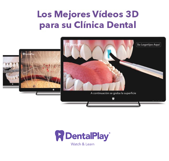 🚩 -40% 😮 PACK VIDEOS EDUCATIVOS 3D DENTALPLAY, CERRARÁS MÁS TRATAMIENTOS 💪