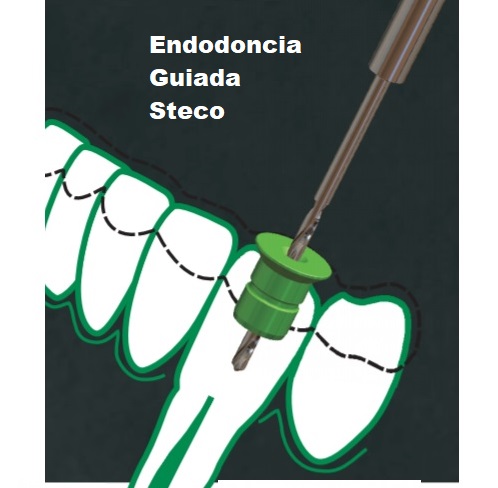 CASQUILLOS STECO DE TITANIO PARA ENDODONCIA GUIADA