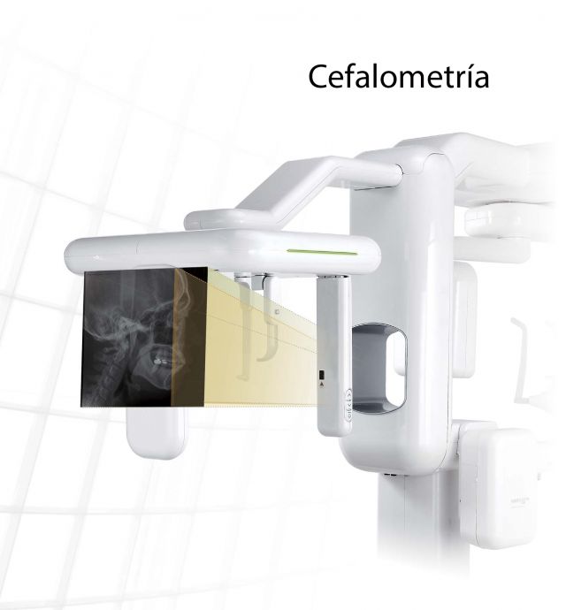 TAC 3D CBCT, Panorámico y Cefalometría - Genoray Papaya 3D Plus