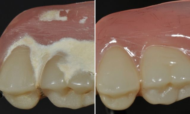 SYMPRO - MÁQUINA LIMPIADORA PARA PROTESIS + PAQUETE PROMOCIONAL